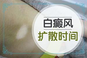 白癫疯较初长在身体的那个部位