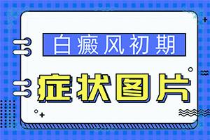 [不可不知]背上有很多白斑是怎么回事