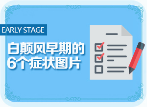 半岁宝宝身上长了一片片白斑是怎么回事