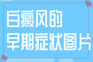 上眼皮下长了一个小白点-白癜风的起因详解