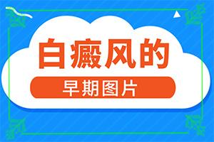 患者下巴皮肤上长有白斑是怎么回事