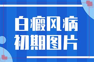 十岁患者身上长白色片是怎么回事