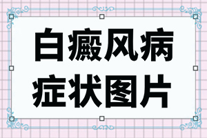 大腿起白斑有细小的皱纹是怎么回事