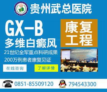 什么是白癜风的潜伏期
