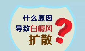 为什么说白癜风不可胡乱用药