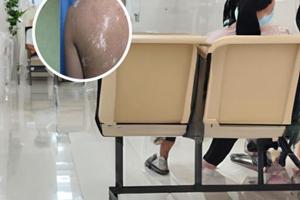 他克莫司用多长时间有效果