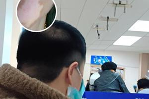 白癜风遗传吗男