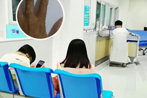 复方甘草酸苷片作用和功效用量