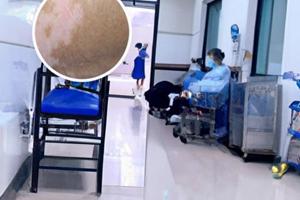 李可老中医治白癜风