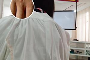 白癜风胶囊功效与作用