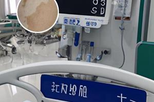 头发黑色素形成需要多长时间