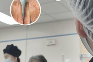 男性睾丸上长白癜风会影响生育吗