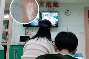 贵州白癜风皮肤病医院门诊上班时间表