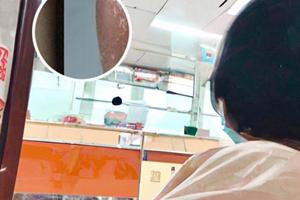 0.03他克莫司软膏的作用与功效