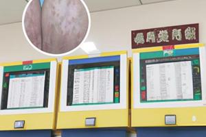白灵酊和他克莫司能一起用吗