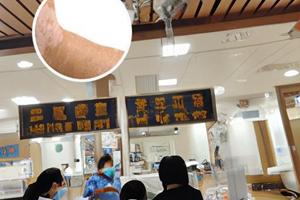 311光疗可长期使用吗为什么检查