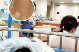 伍德灯有什么用处