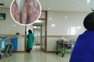 乌龙散的用药注意事项