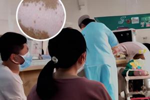 伍德灯下绿色荧光是什么