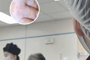 他克莫司用多长时间可以停药