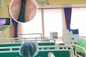 他克莫司与红霉素可以一起用吗