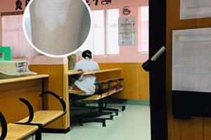 他克莫司软膏治白点疯吗