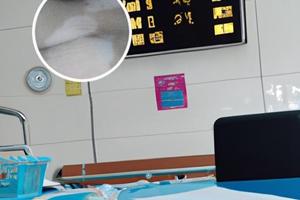 白癜风吃什么食物可以缓解病情