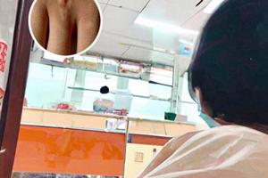 白殿疯病能吃鸡肉吗