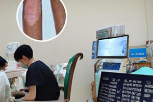 黑色素减少吃什么补充蛋白质好