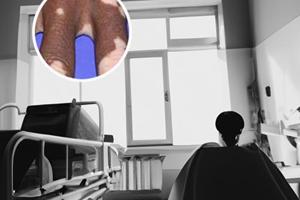 四个月宝宝脖子里有一片片色素脱失症怎么回事