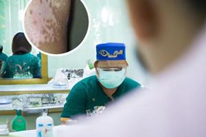 西格玛308白癜风光疗仪使用时间