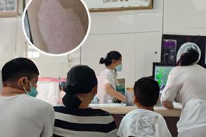 贵阳白斑病医院地址