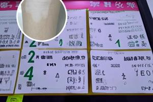 氦氖激光照射治疗皮肤图片