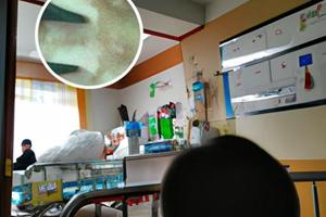 308激光10次后可以停吗为什么
