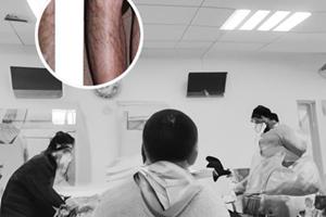 伍德灯检查阴性