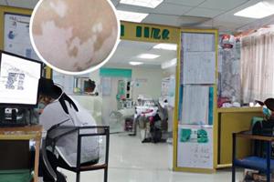 六盘水治疗白癜风哪个医院好