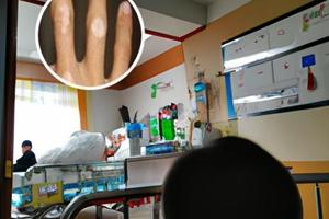 六盘水白点癫疯医院地址