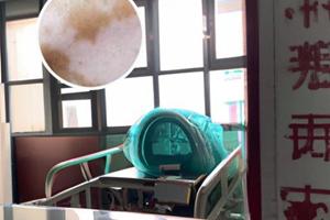 黔西南外阴白斑医院去哪家好