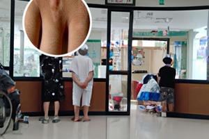 贵州白斑病医院排名