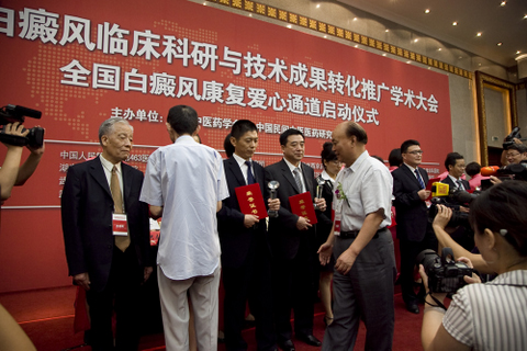 心理因素可以左右白癜风治果