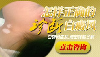 白癜风早期诊断有什么方法