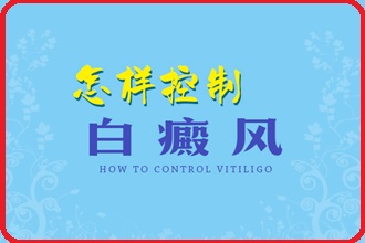 这些方面白癞风患者要谨记，以免病情错误治疗