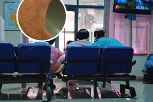 小孩子手臂上有色素脱失症要怎么办图片