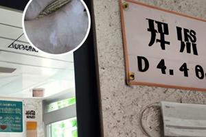 308激光治疗多少次会治好