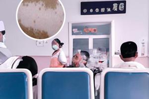 308激光照了一年半还要照吗为什么