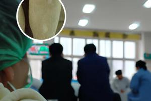 308激光对眼睛有影响吗