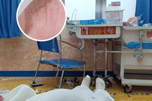 311白班激光治疗仪
