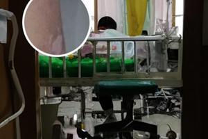 新生儿额头有色素减退斑怎么回事图片