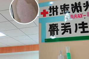 皮肤镜检查什么样的结果提示癌细胞
