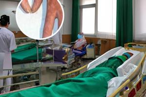 兰州中研白癜风医院口碑怎样